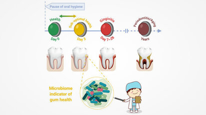 Study identifies asymptomatic state of gingivae that links gingivitis, periodontitis and ageing