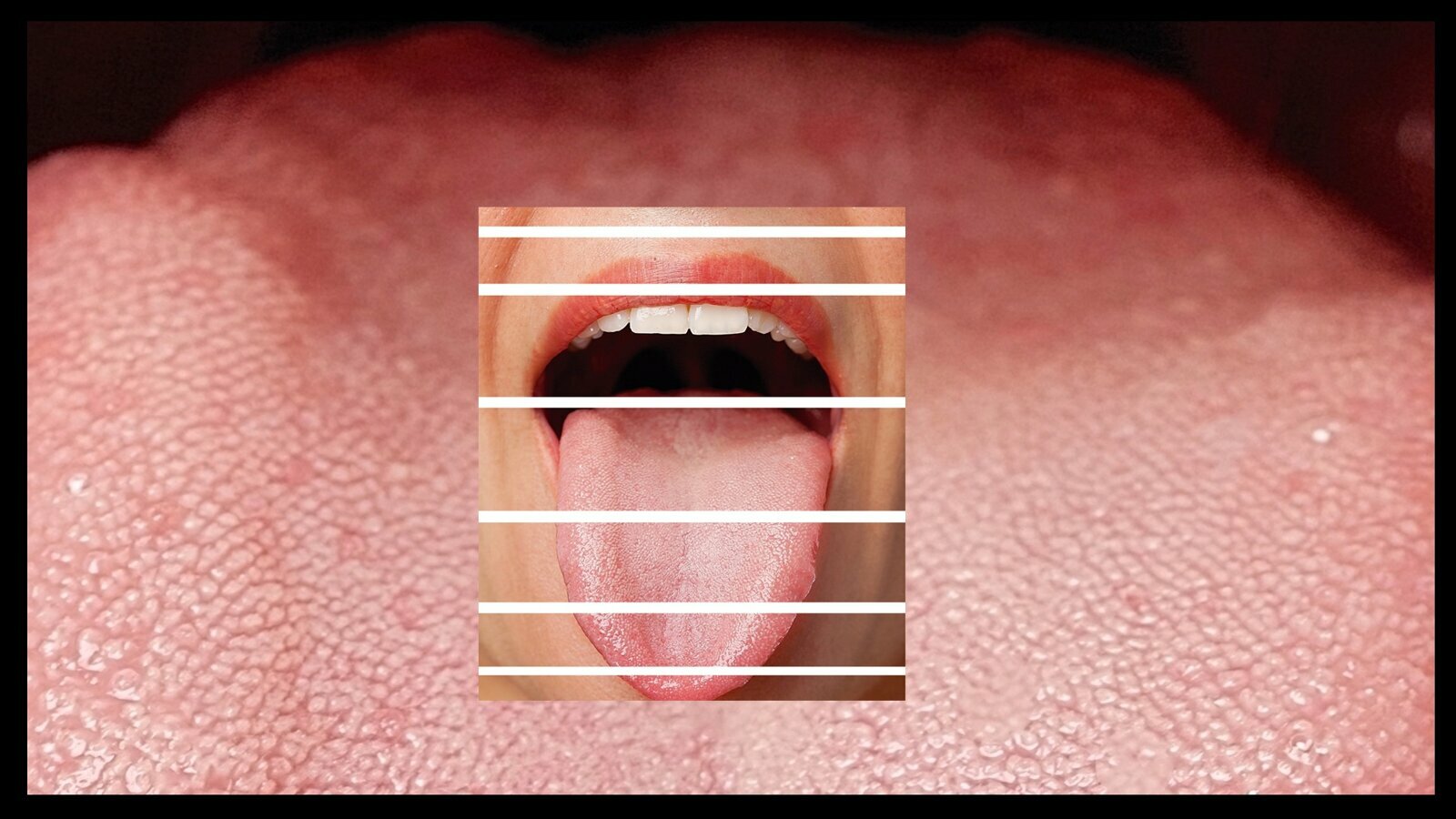 La detección precoz del cáncer oral en la consulta (5)