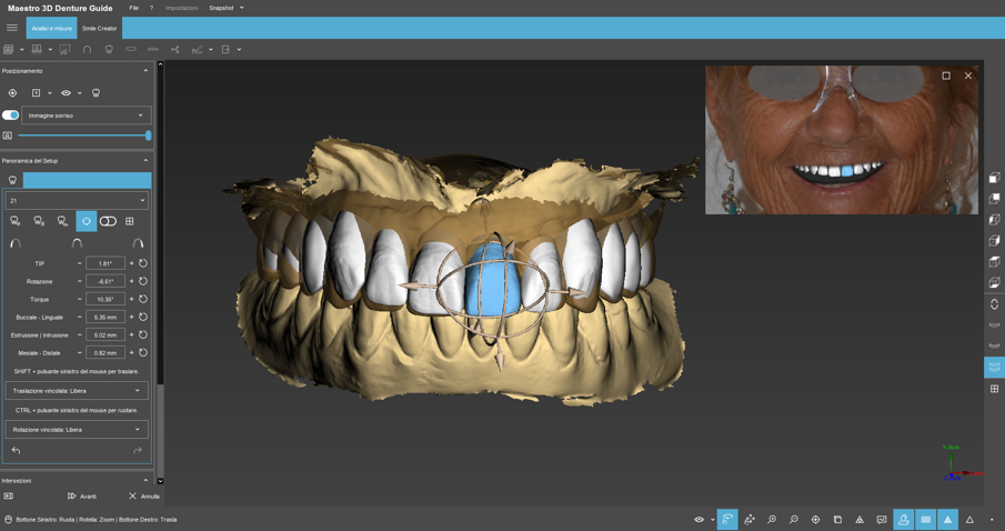 Fig. 15 - Ogni spostamento o modifica di asse del dente è visibile direttamente nella foto del viso.