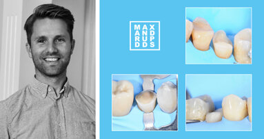 Interview: “It all starts with the right dentine bonding agent”