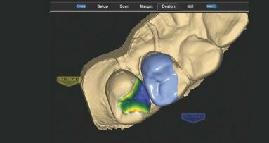 E4D chairside CAD/CAM restorations: Case presentations and lessons learned