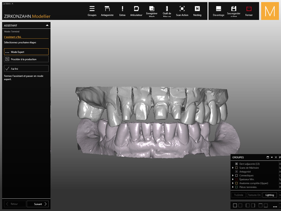 Fig. 7: Digital models of the maxillary and mandibular arches.