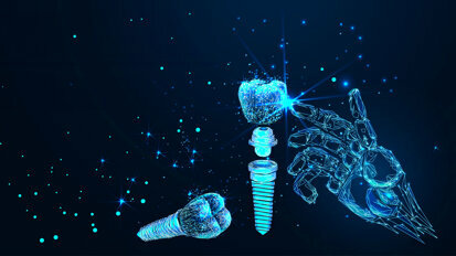 Post-COVID recovery fuels success of cost-conscious dental implant solutions and digital dentistry