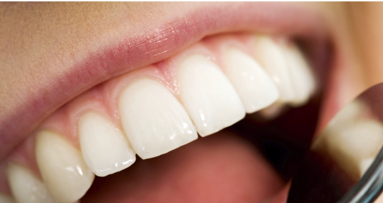 Il valido contributo dell’igienista dentale nell’individuazione del cancro orale