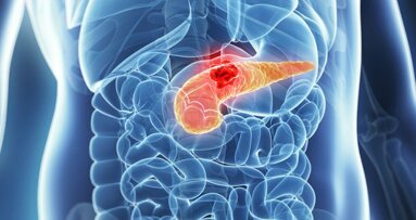 Novo teste de saliva pode detectar tumores no pâncreas