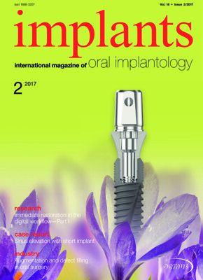 implants international No. 2, 2017