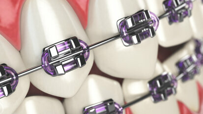 Le Covid-19 poussera-t-il l'orthodontie plus loin dans l'espace numérique ?