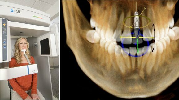 KaVo e Henry Schein anunciam agenda para Congresso Odontológico de Imagem 3-D