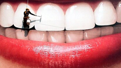 Zubna caklina oslabljena izbeljivanjem