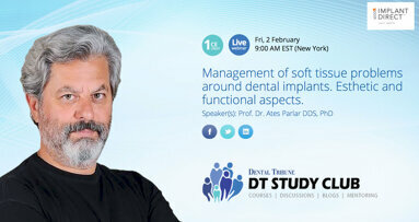 Free webinar to focus on management of soft tissue around implants