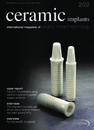ceramic implants international No. 2, 2022