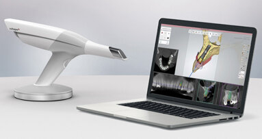 Sólo implantát: Náhrada horního premoláru pomocí digitálního pracovního postupu