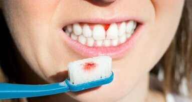 Forse besparingen en betere gezondheid door preventie van parodontitis