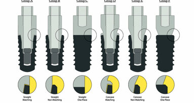 Canine study finds implant-abutment interface configuration may influence crestal bone changes