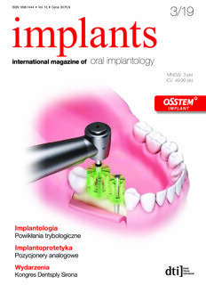implants Poland No. 3, 2019