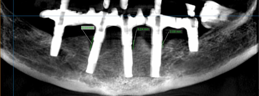 Figure 1. Radiographic assessment at baseline.