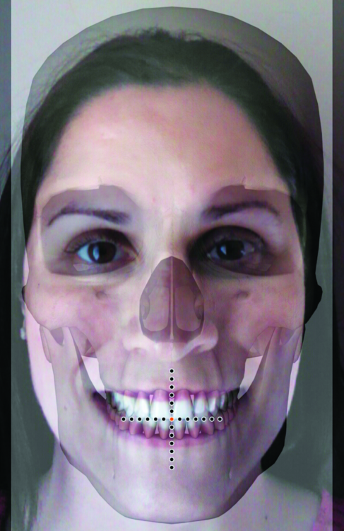 Fig. 6: Screenshot face-skull