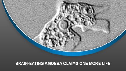 Brain-eating amoeba claims one more life
