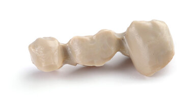 Protesi dentale premium non metallica: Juvora approvata per corone e ponti dentali
