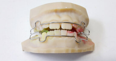 Zhotovení ortodontických aparátů na 3D tištěné modely