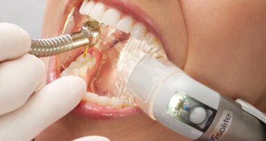 Isolite delivers dental isolation technology