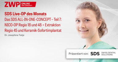 1 CME-Punkt: Live-OP „Das SDS ALL-IN-ONE-CONCEPT – Teil 7“ im Archiv