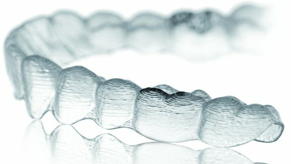 Zahnbegradigung ohne KFO: Webinar stellt Methode für Zahnärzte/-innen vor