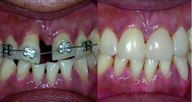 MiCD: Do no harm cosmetic dentistry—Part I