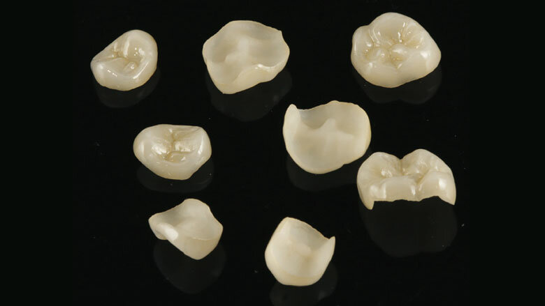 Figure 14: The pressed ceramic restorations prior to placement