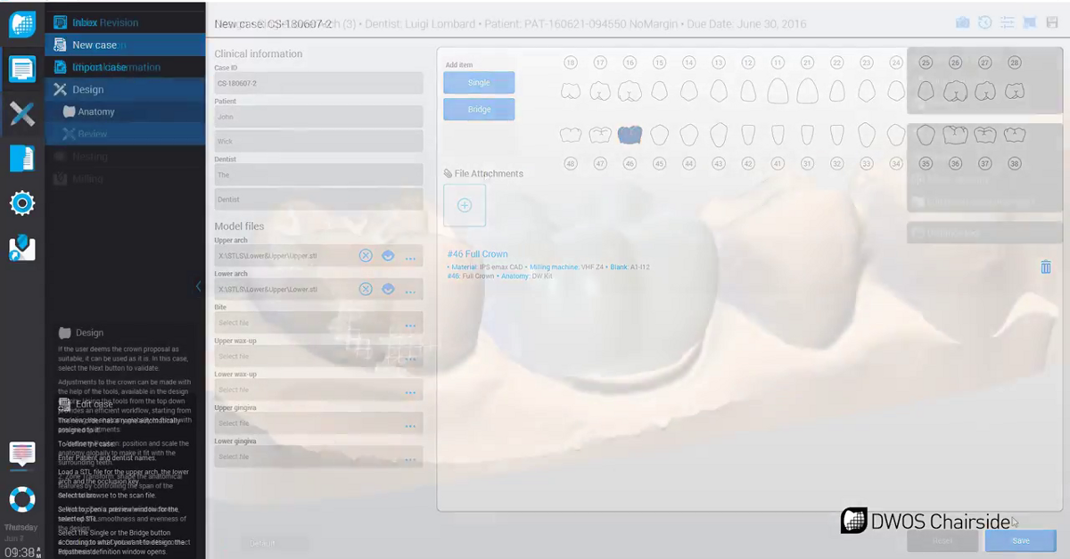 Dental Wings - DWOS CAD_CAM Design Software Integrates vhf camfacture ...