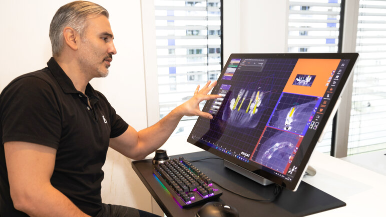 DT News - International - Exocad releases new versions of its chairside ...