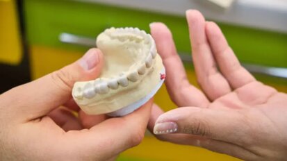 3D принтираните зъби за протези са подходящи за дългосрочна клинична употреба