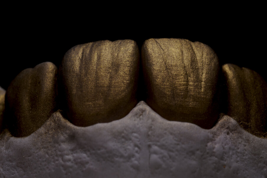 Fig. 30 - Texture esterna con polvere d'oro e dettagli di superficie.
