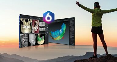 Introducing Planmeca Romexis 6.0—new version of world-leading software