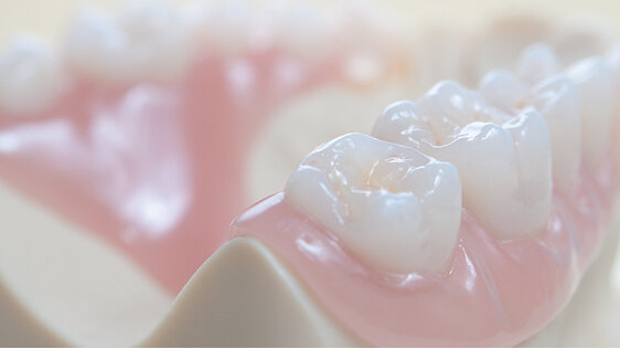 Termoplastické materiály v dentálních technologiích