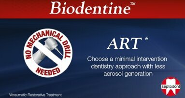 Biodentine and ART: Minimising droplets and aerosol generation