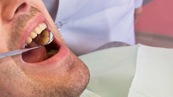Czym jest starzenie dentalne?