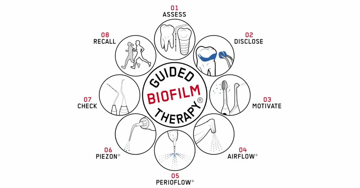 Patient undergoing chemotherapy gets a dental cleaning (Guided Biofilm