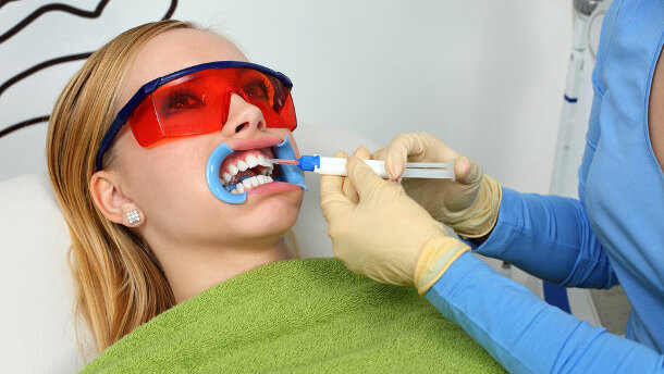 Number of teeth whitening treatments expected to increase