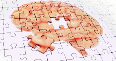 Uno studio conferma come la recessione gengivale aumenti il rischio di sviluppare l’Alzheimer