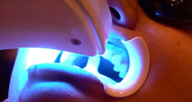 El descontrolado uso de lámparas de blanqueamiento dental