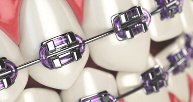 Will COVID-19 push orthodontics further into the digital space?