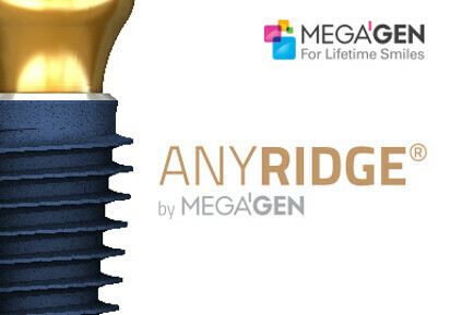 MegaGen AnyRidge Implant system
