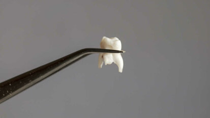 Algorytmy uczenia maszynowego mogą pomóc w przewidywaniu utraty zębów