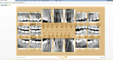 Curve Dental’s new Web-based digital imaging technology poised to change how dentists capture, store and access patient information
