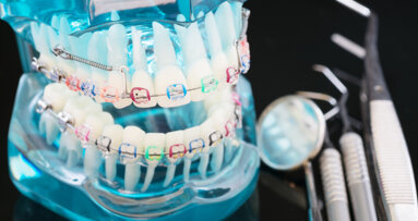 Orthodontic treatment does not guarantee better psychosocial functioning later in life.