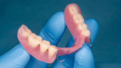 Removable partial dentures may improve mortality among partially edentulous adults