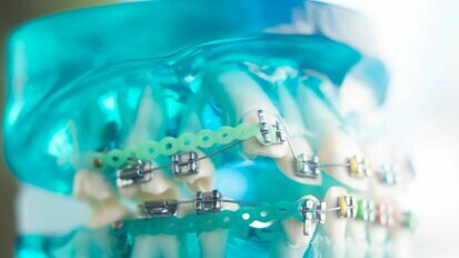 Kunstmatige intelligentie stroomlijnt orthodontie