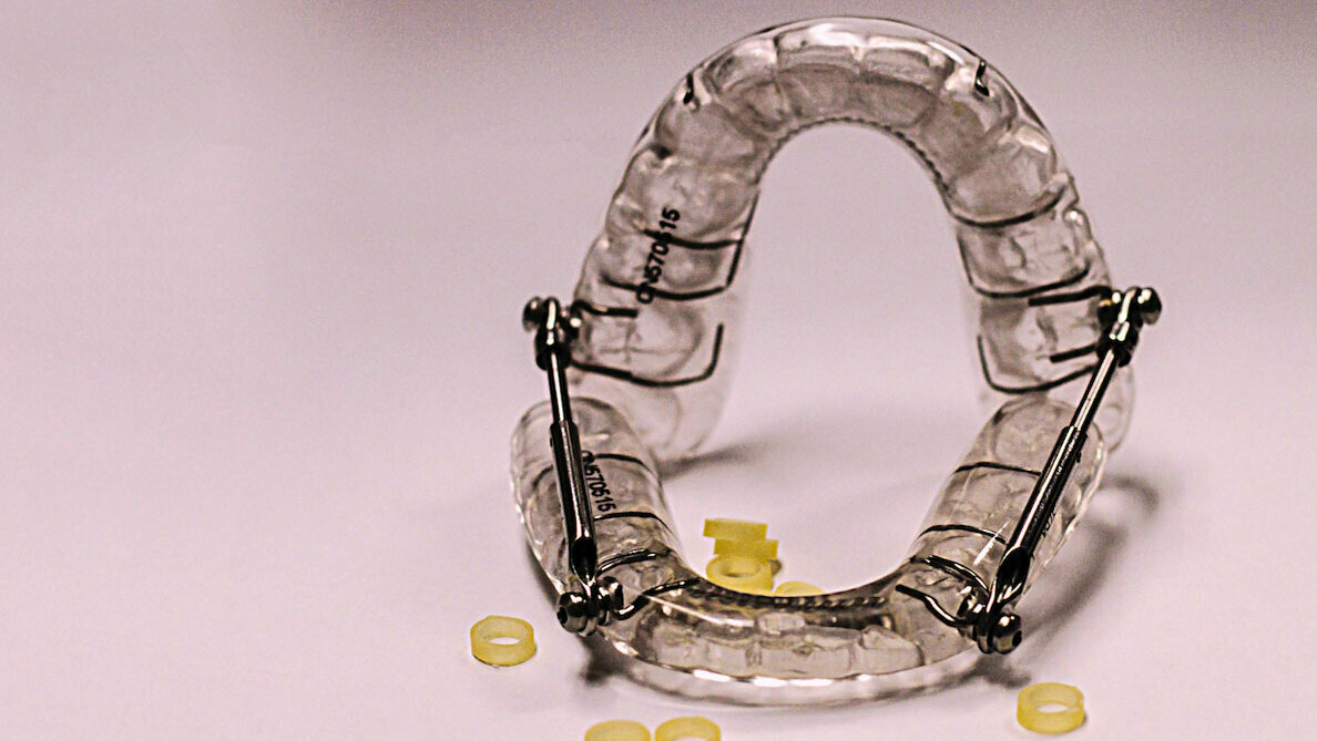 Dispositivos de avance mandibular