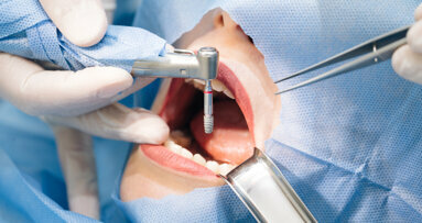 dentalcorp and Envista Partner to Deliver Dental Implants Across 500 Locations: Revolutionizing Dental Healthcare